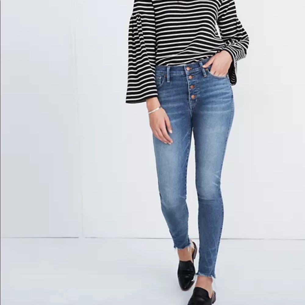 Madewell | Button Fly Raw Hem High Rise Skinny Jeans